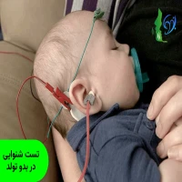 تست شنوایی در بدو تولد